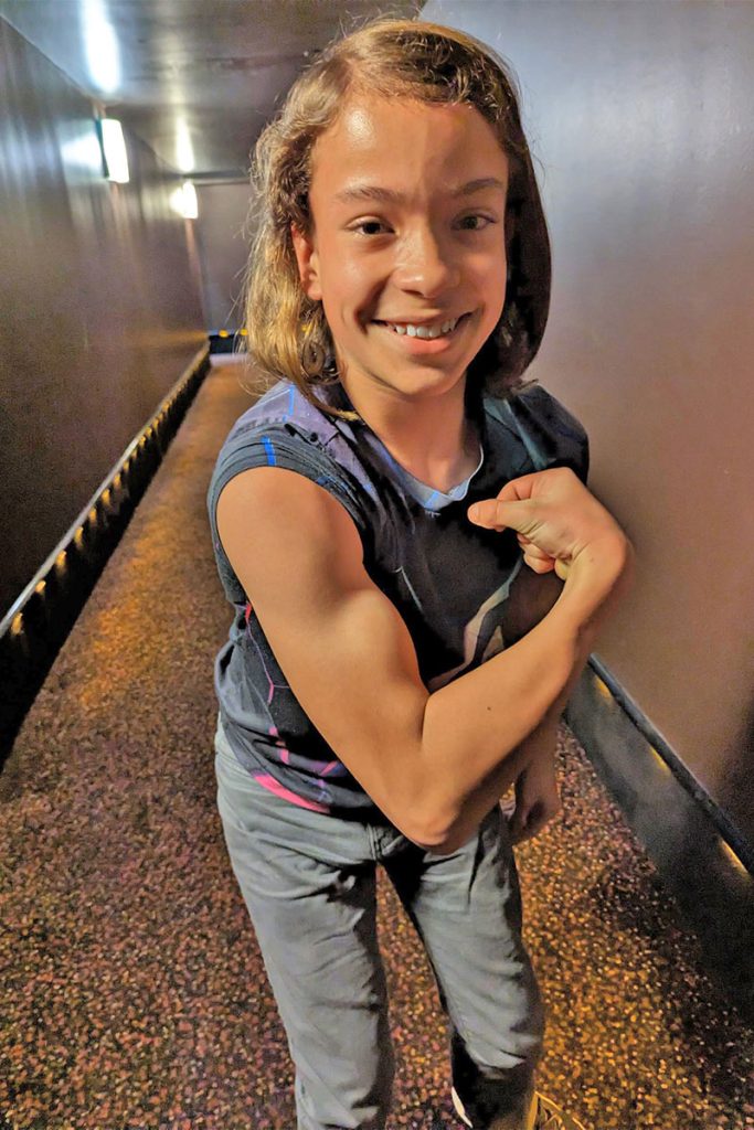 Today, Liam Austin walks independently using only leg braces.